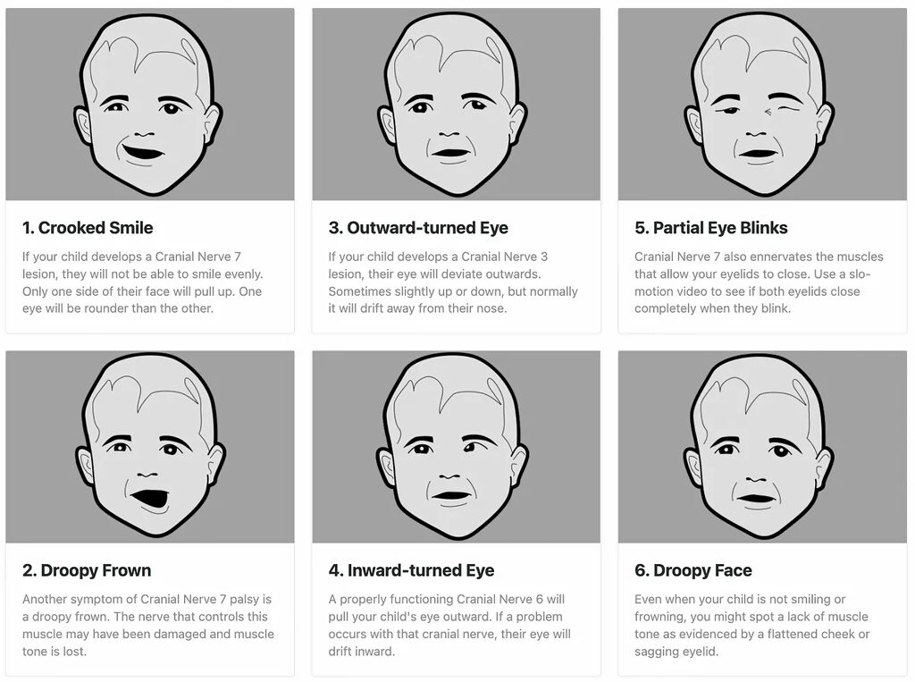Click to enlarge chart facial asymmetry child bad diet vaccination
