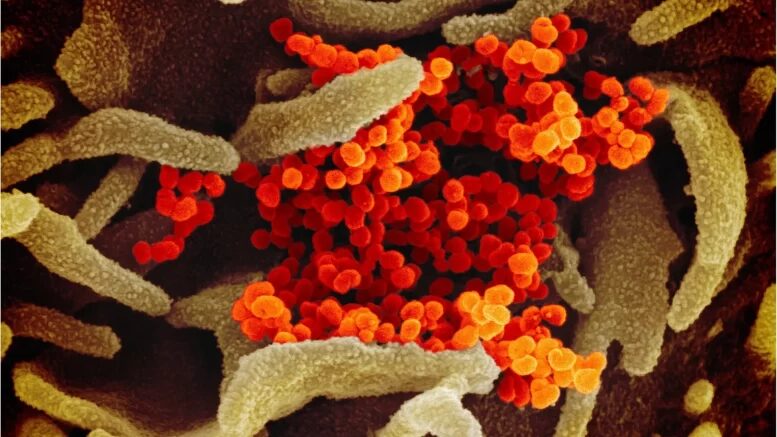 This scanning electron microscope image shows SARS-CoV-2