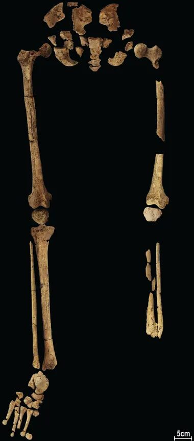 Click to enlarge surgery archeology