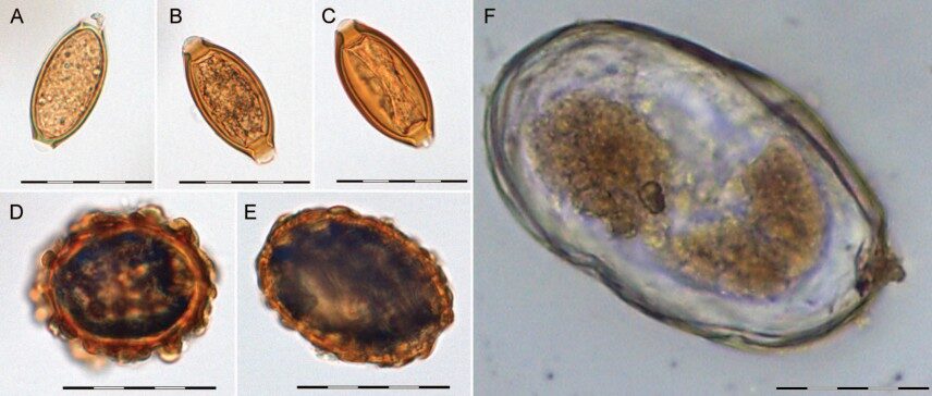 Whipworm egg
