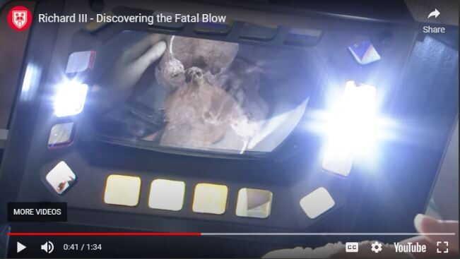 Click to enlarge Richard III - Discovering the Fatal Blow