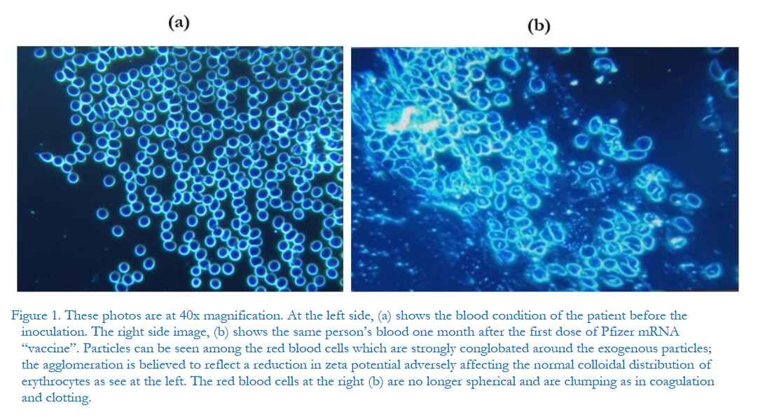 Dark-Field Microscopic Analysis Blood