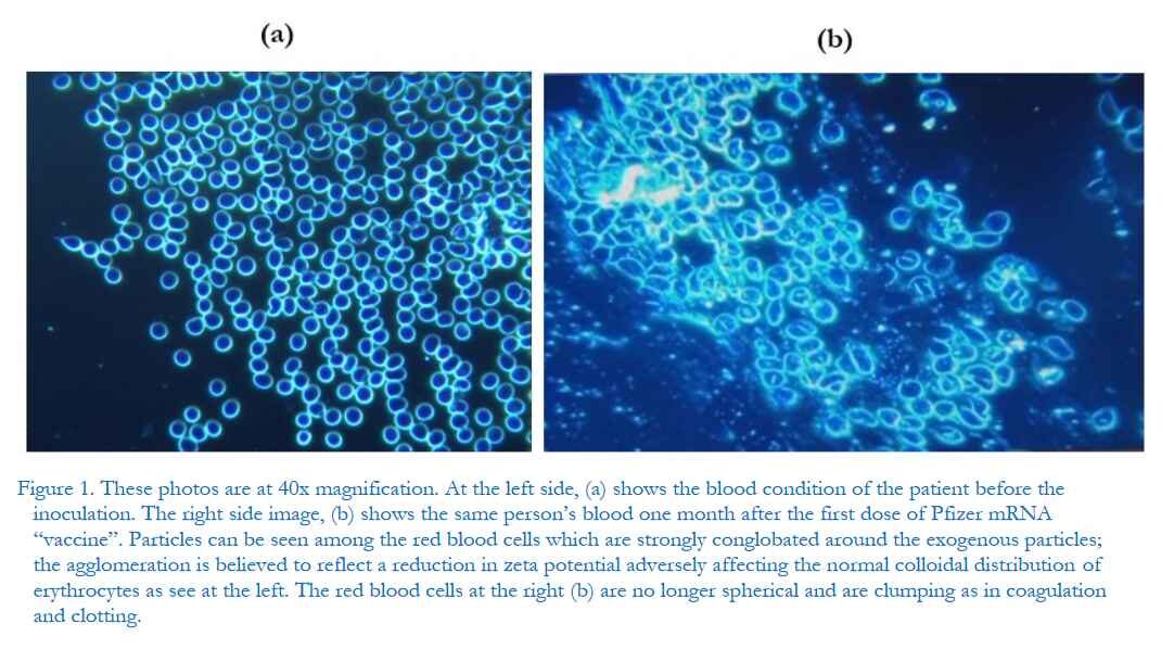 Dark-Field Microscopic Analysis Blood
