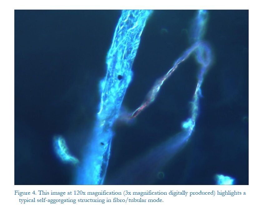 Dark -Field MicroscopicAnalysis on the Blood