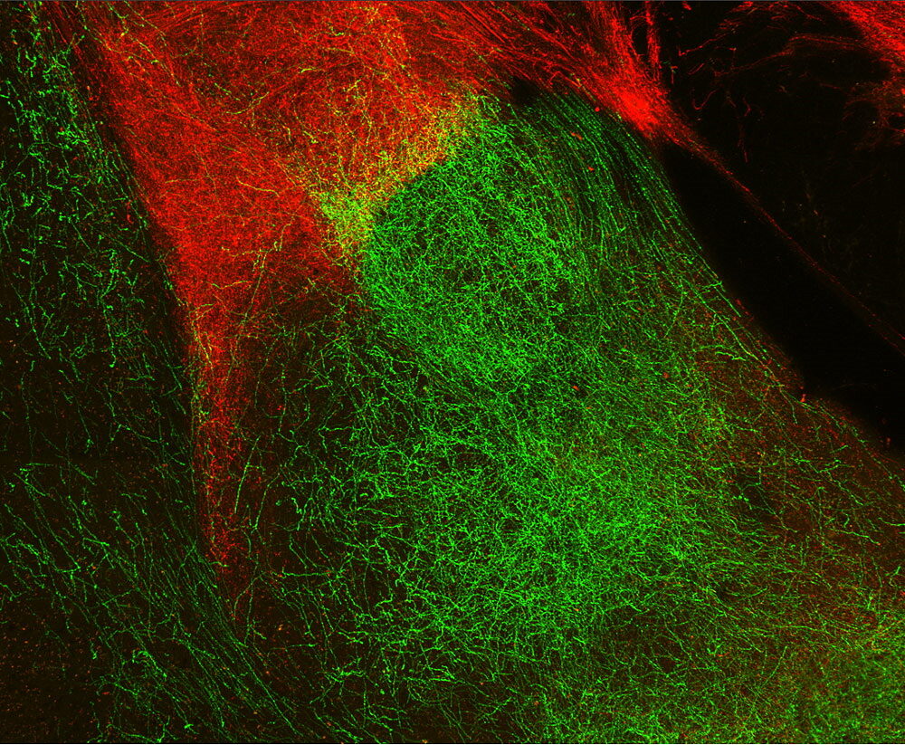 Click to enlarge good bad memory brain molecule neural network
