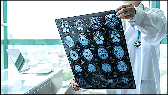 brain scans