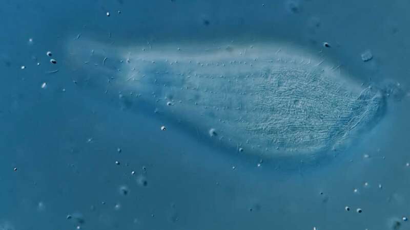 Click to enlarge Apertospathula, a microbe