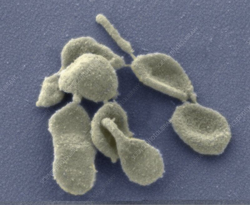 Click to enlarge Mycoplasma genitalium