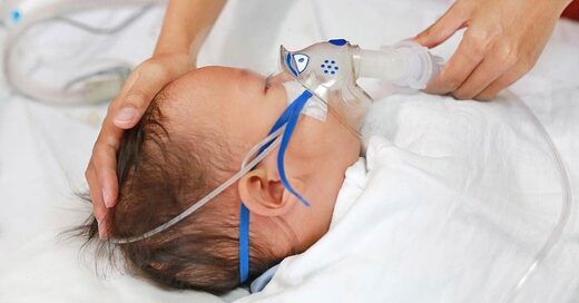 rsv baby ventilator