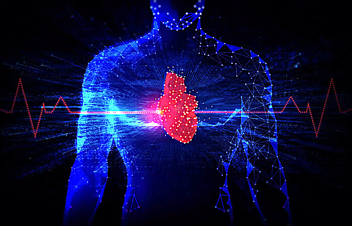 myocarditis