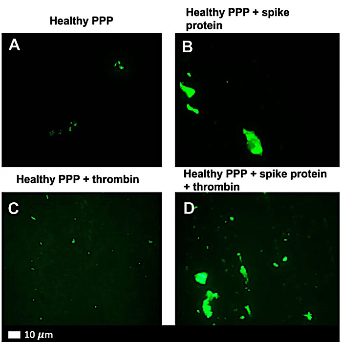 Click to enlarge 4 PPP boxes