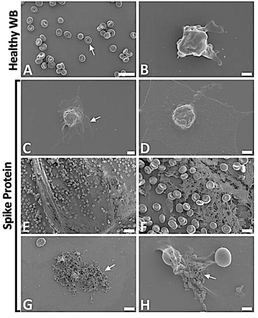 electron microscope images