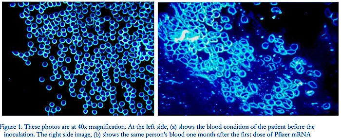 Click to enlarge 2 blue boxes