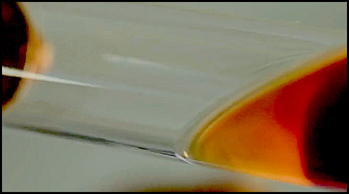 Click to enlarge blood separation