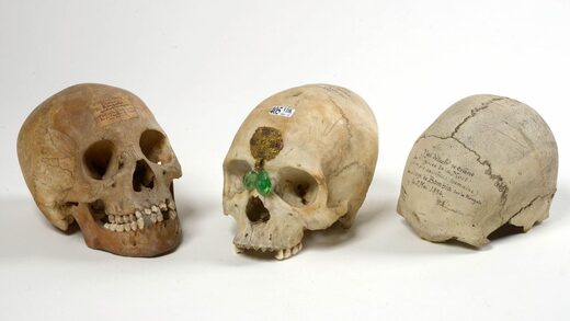Brussels auctioneers retract sales of colonial era human skulls from Congo following backlash