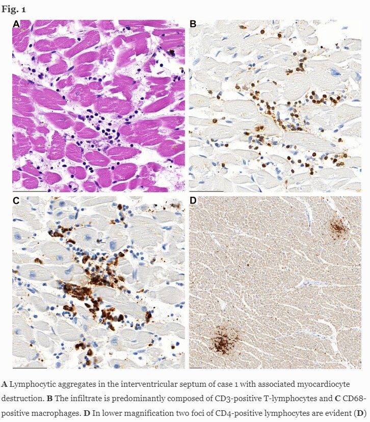 heart inflammation report 2