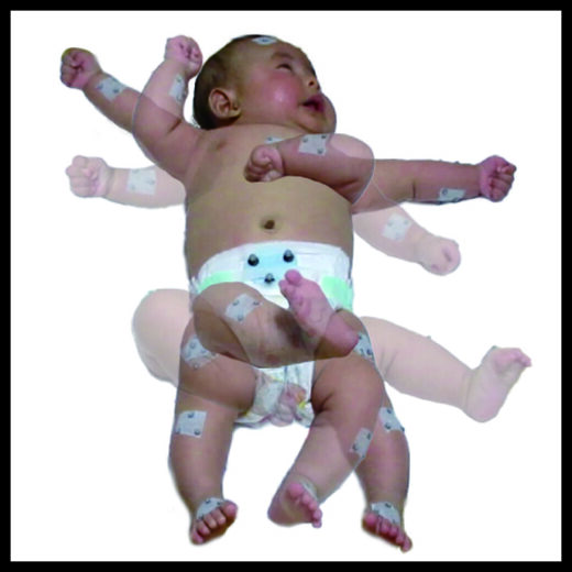 Click to enlarge Spontaneous movements.