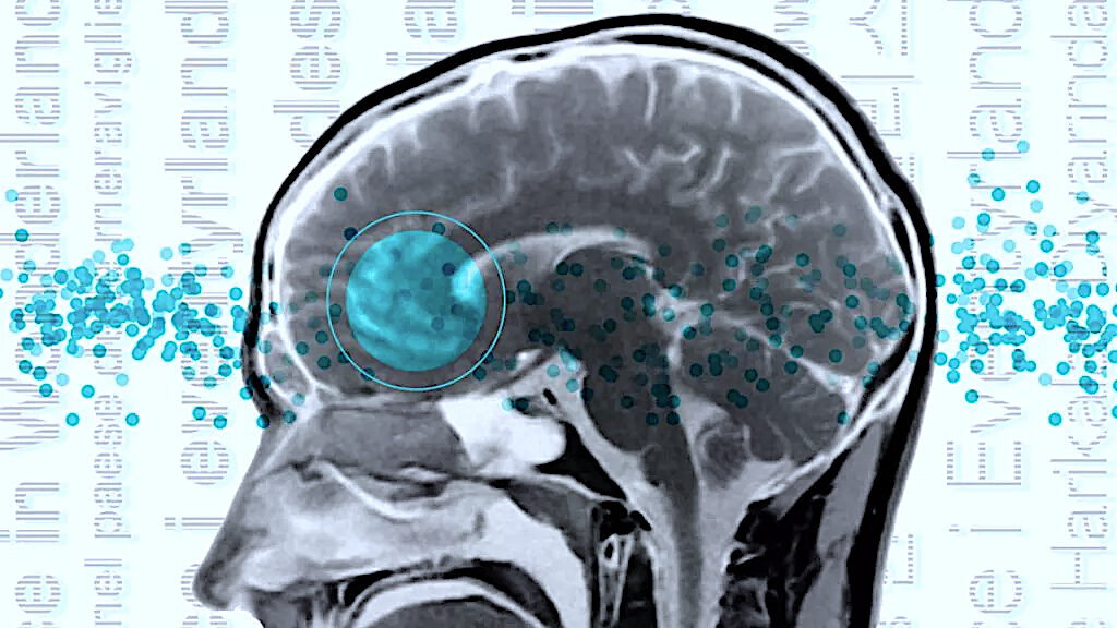 brain