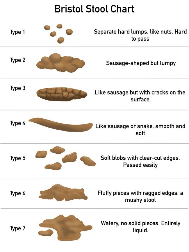 bristol stool chart