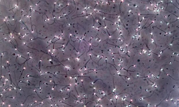 sperm