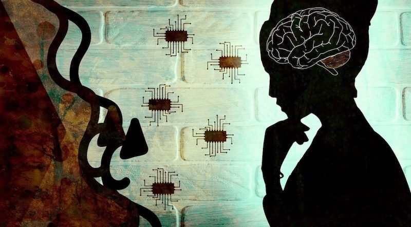 Microchip Implants