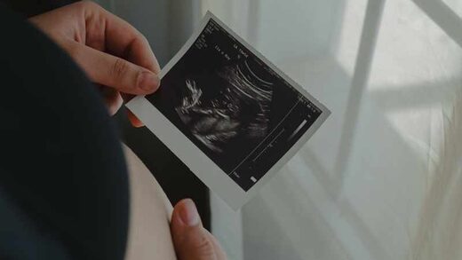 Click to enlarge pregnancy birth baby scan