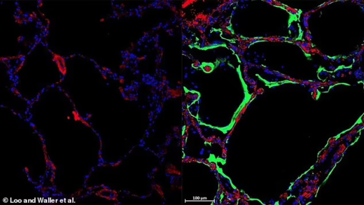 Click to enlarge covid fighting protein lungs