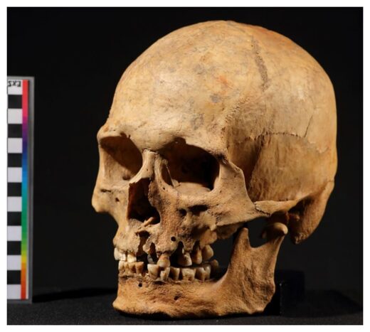 Click to enlarge Skull of the Nizhnetytkesken individual.
