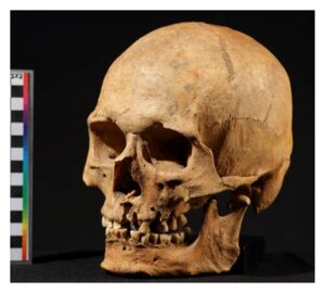 Skull of the Nizhnetytkesken individual.