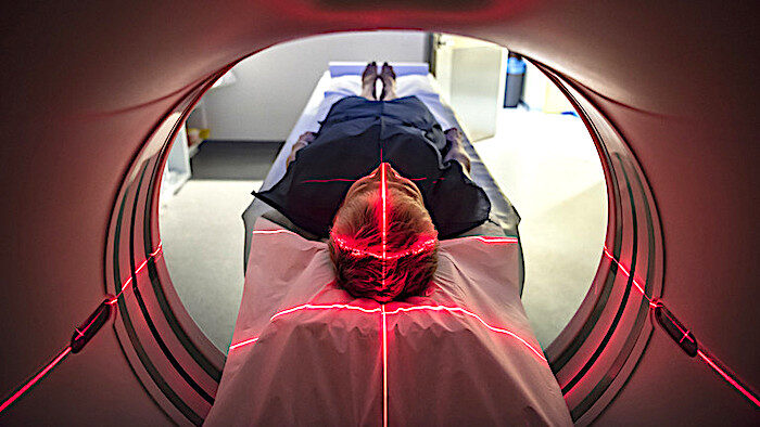 MRI scan