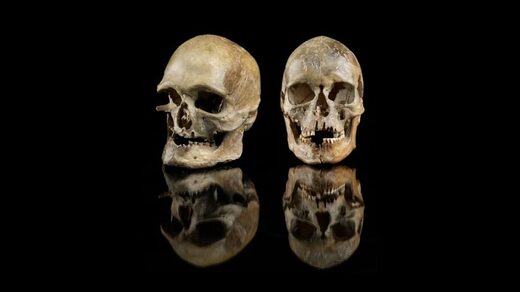 Click to enlarge male and female skulls