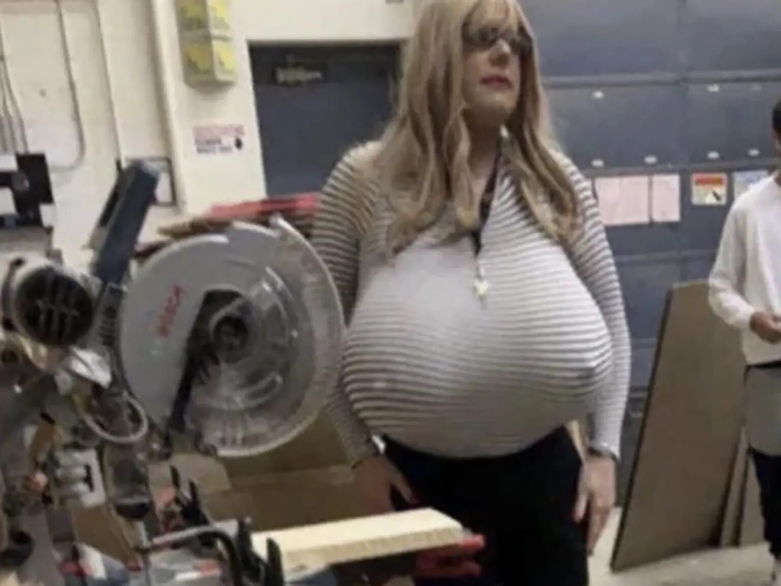 Kayla Lemieux prosthetic breasts teacher