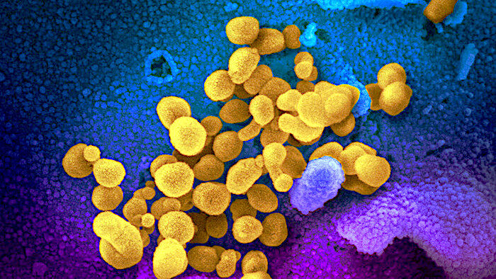 SARS virus
