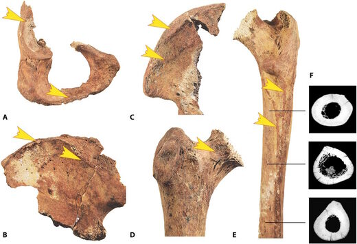 Click to enlarge bone changes horse riders
