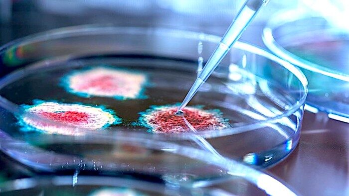 petri dish