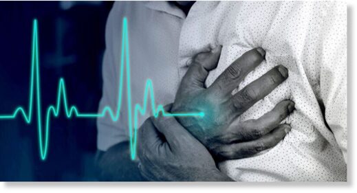 myocarditis