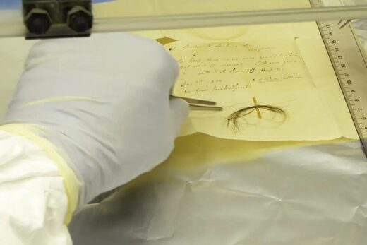 Click to enlarge Beethoven hair dna cause of death