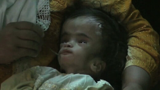 iraq depleted uranium birthd efects