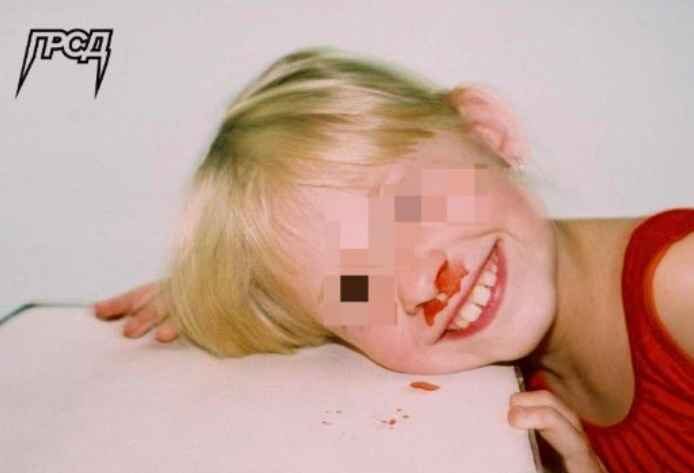 gorsad child nose bleed