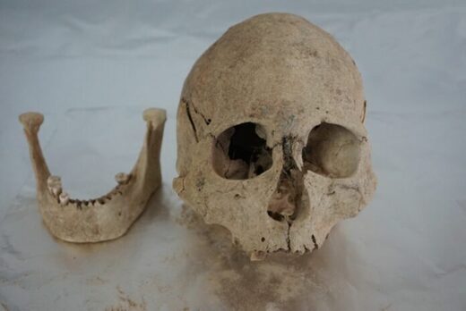 skull