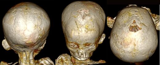 egyptian mummy child