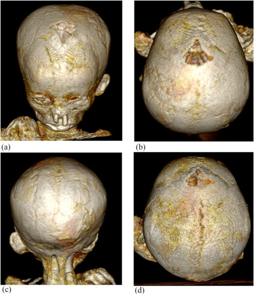 Click to enlarge egyptian mummy child