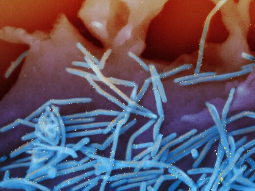 Click to enlarge respiratory syncytial virus (RSV)