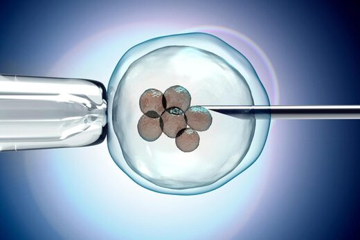 IVF invitro fertilization