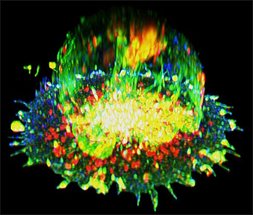 T cell white blood cell activation immune system tumors