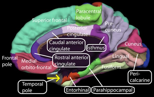 brain regions