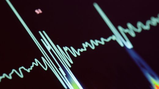 heart rate monitor