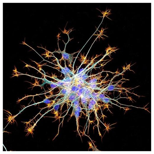 Click to enlarge Neurons