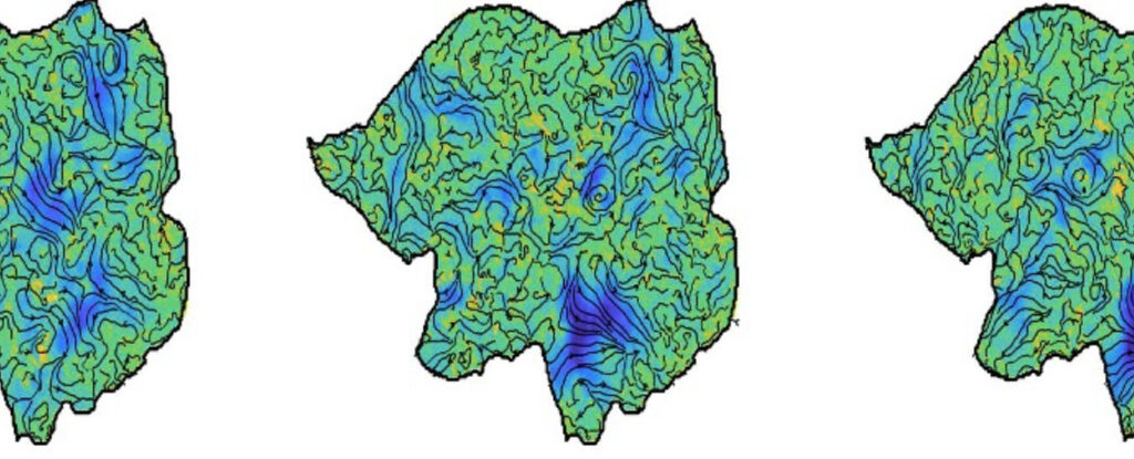 brain spiral