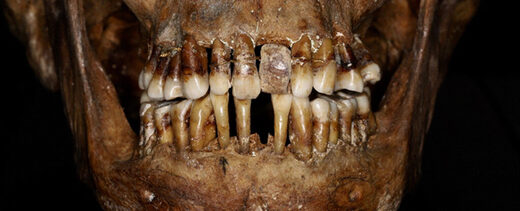 teeth aristocrat